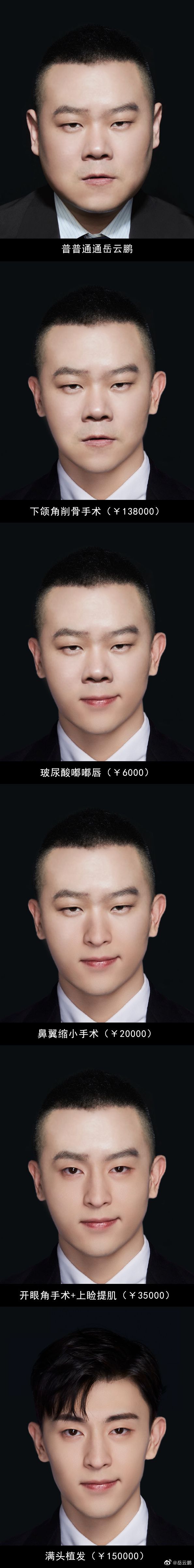 每日一笑之岳云鹏把自己p成邓伦
