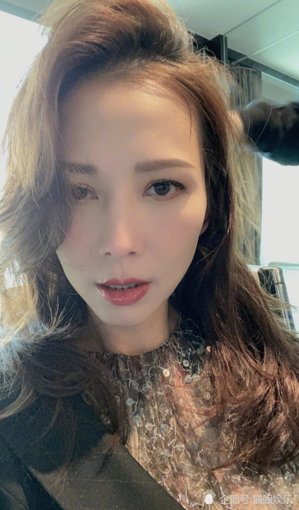 47岁蔡少芬发际线后退大额头抢眼，晒照成蛇精脸，为了美脸插十几针