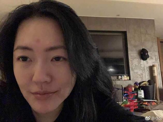 小S被虫咬到额头自侃是菩萨 